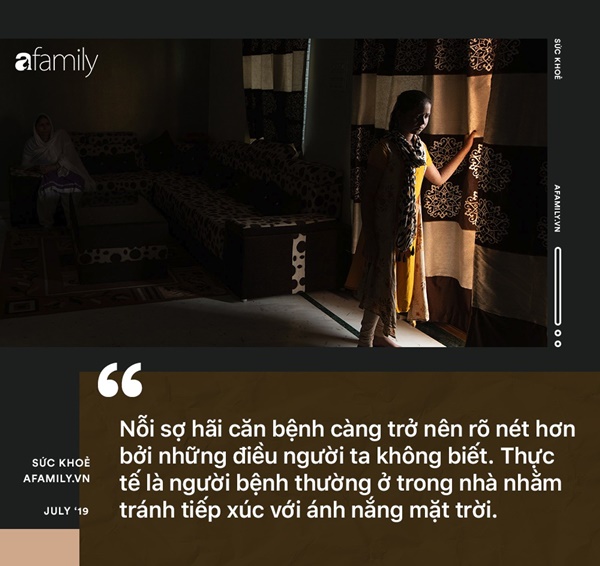 Hậu quả từ các cuộc hôn nhân cận huyết: Những đứa trẻ đang chết dần chết mòn bởi… ánh nắng mặt trời-4