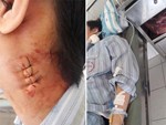 Chẩn đoán có u bên phải, bác sĩ lại mổ bên trái: Bệnh viện ở Quảng Nam lên tiếng-2