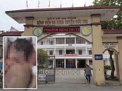 Công an Hà Tĩnh chỉ đạo điều tra nguyên nhân trẻ sơ sinh tử vong với vết đứt quanh cổ-3