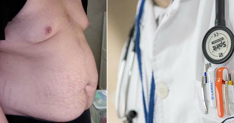 Chuyện lạ mà có thật về chàng trai ngoài hành tinh, nhịn ăn 382 ngày vẫn sống khỏe mạnh như thường-3