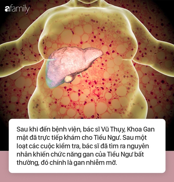 Cậu bé mới 5 tuổi đã bị gan nhiễm mỡ, thủ phạm chính là loại thực phẩm hầu hết trẻ em đều thích và thường ăn-1