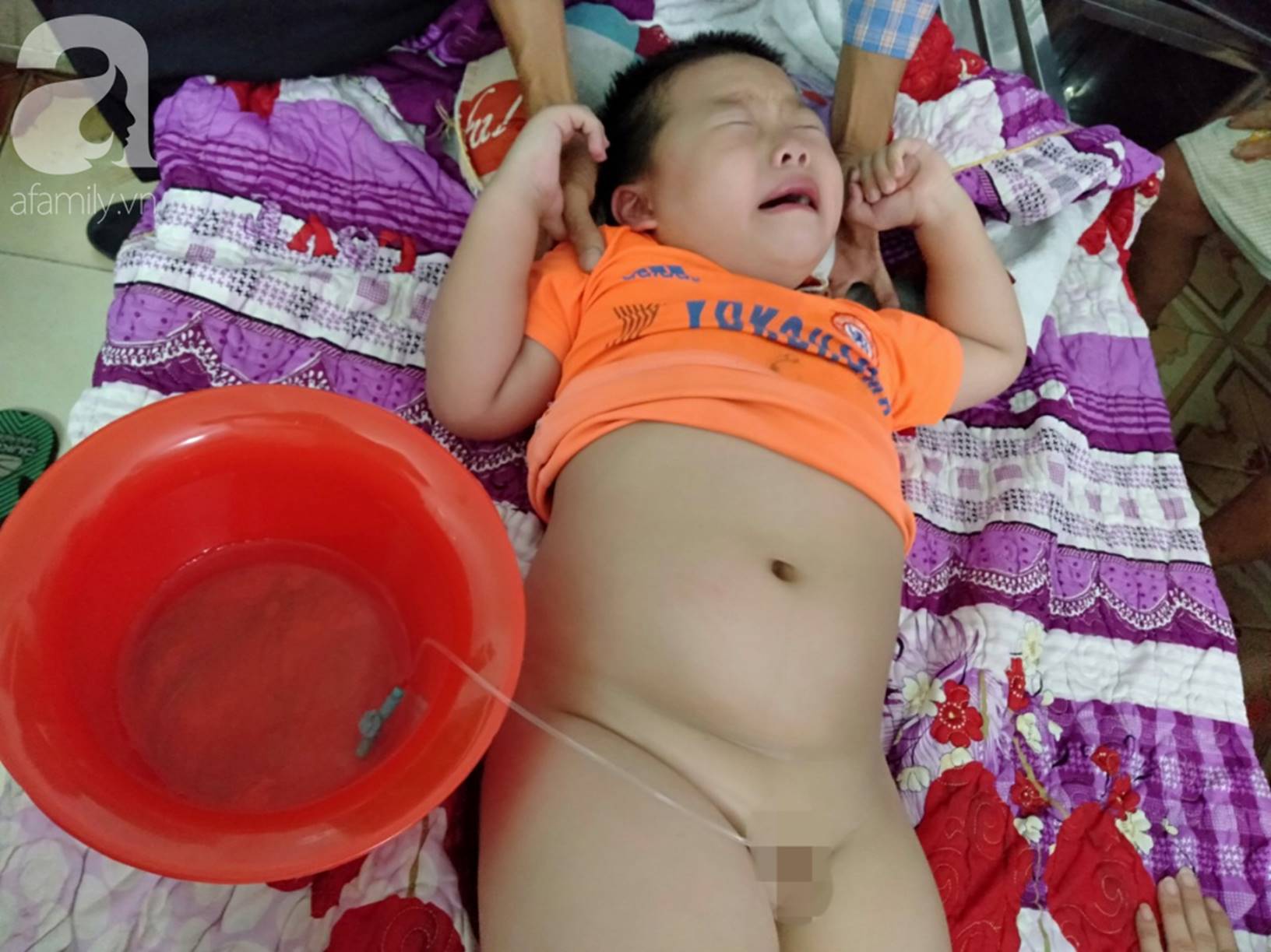 Vợ chồng nghèo cầu cứu 100 triệu đồng cho con trai 7 tuổi mắc bệnh thận có cơ hội phẫu thuật, giành lại sự sống-1