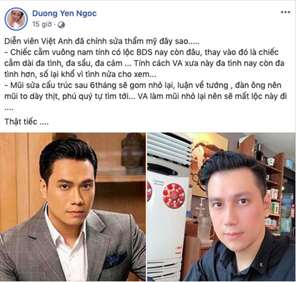 Việt Anh bị chê phá tướng sau khi phẫu thuật, Quế Vân gay gắt bênh vực: Có ai phẫu thuật xong 6 ngày đã đẹp luôn chưa?-4