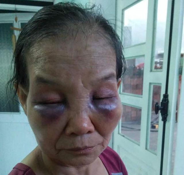 Con dâu đánh mẹ chồng ở Bình Phước bị phạt 2 triệu, tiết lộ thêm câu chuyện-1