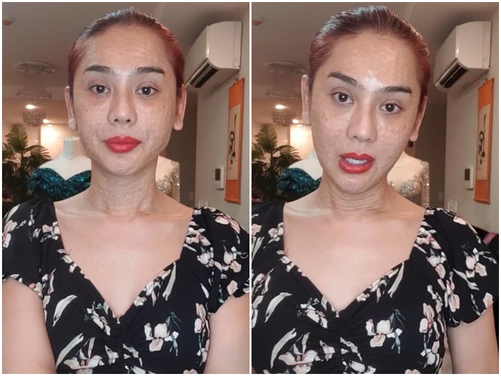 Vừa gây sốc với gương mặt chi chít nốt sần, Lâm Khánh Chi vẫn tự tin đi chơi và khẳng định: Em cứ xinh đẹp bất chấp giữa dòng đời xuôi ngược-1