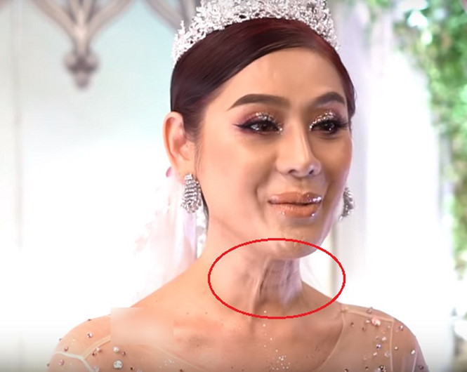 Vừa gây sốc với gương mặt chi chít nốt sần, Lâm Khánh Chi vẫn tự tin đi chơi và khẳng định: Em cứ xinh đẹp bất chấp giữa dòng đời xuôi ngược-2