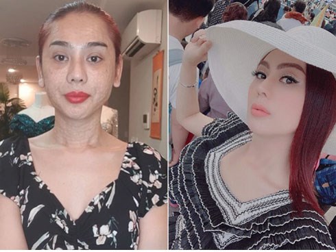 Vừa gây sốc với gương mặt chi chít nốt sần, Lâm Khánh Chi vẫn tự tin đi chơi và khẳng định: 'Em cứ xinh đẹp bất chấp giữa dòng đời xuôi ngược'