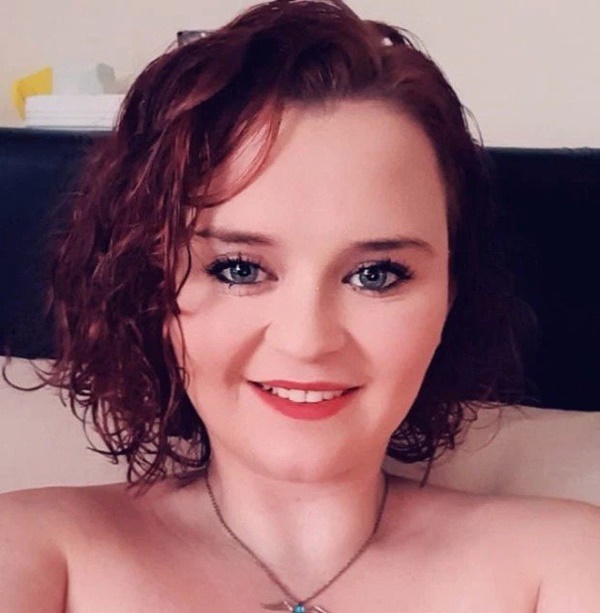 Sau đêm thức khuya xem tivi, cô gái 23 tuổi bị liệt nửa người-2