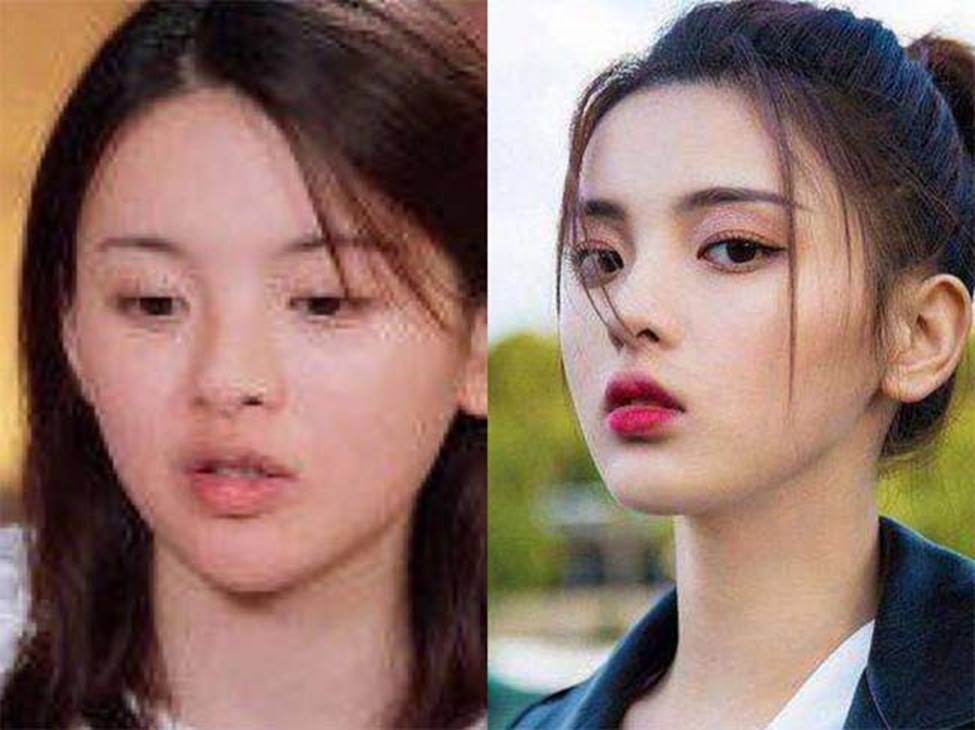 Cô thôn nữ 21 tuổi được phong đẹp nhất Trung Quốc bị ném đá vì nghi mặt nhân tạo-5