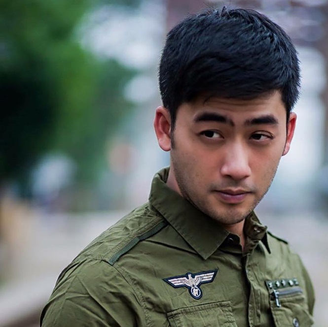 Mặt phẫu thuật thẩm mỹ còn chưa lành hẳn, Việt Anh còn dụ thêm cả Hồng Đăng, Bảo ngậu dao kéo chung-7