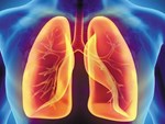 90% gia đình Việt có 8 thứ là sát thủ của 2 lá phổi, nguy cơ gây ung thư cao-9