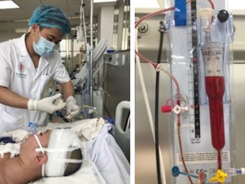 Đột ngột đau đầu, thiếu nữ 18 rơi vào hôn mê do ‘kẻ giết người’ thứ 3 ở Việt Nam