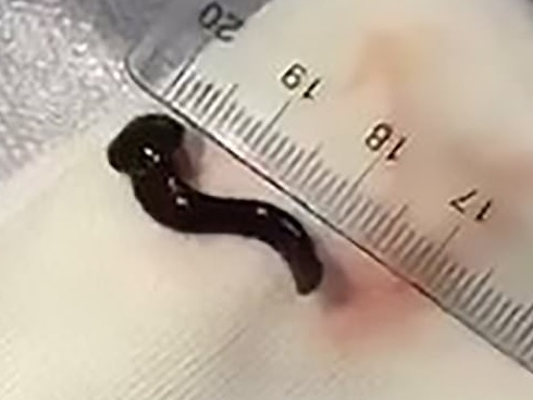 7 thói quen giết chết tinh trùng, quý ông phải bỏ ngay nếu muốn có tin vui-8