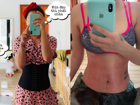 Chanh đang vào mùa, cứ thái lát mỏng rồi đặt lên bụng, bạn sẽ ngạc nhiên sau 1 tuần-7