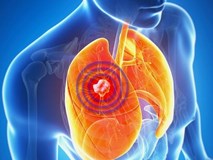 90% gia đình Việt có 8 thứ là 'sát thủ' của 2 lá phổi, nguy cơ gây ung thư cao 90% gia đình Việt có 8 thứ là 'sát thủ' của 2 lá phổi, nguy cơ gây ung thư cao