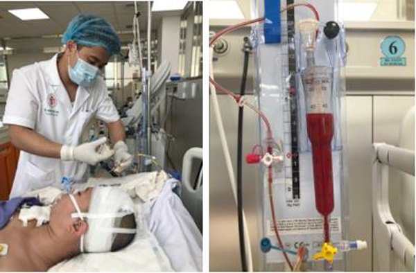 Chủ quan với cơn đau đầu, thiếu nữ bị hôn mê sâu vì lý do ít ai ngờ tới-1