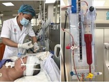 Chủ quan với cơn đau đầu, thiếu nữ bị hôn mê sâu vì lý do ít ai ngờ tới Chủ quan với cơn đau đầu, thiếu nữ bị hôn mê sâu vì lý do ít ai ngờ tới
