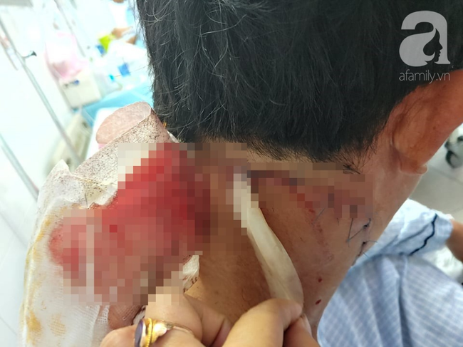 Lời kể của tài xế bị cắt cổ cướp hết tài sản ở Bình Dương: Lúc đó có nhiều người chứng kiến nhưng không ai dám lại gần-3