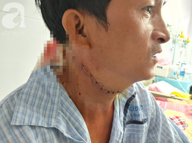 Lời kể của tài xế bị cắt cổ cướp hết tài sản ở Bình Dương: Lúc đó có nhiều người chứng kiến nhưng không ai dám lại gần-4