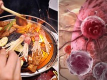 Bác sĩ ung bướu tiết lộ 6 thủ phạm gây ung thư ác tính, dù là ai cũng cần đọc kỹ để tự cứu mình Bác sĩ ung bướu tiết lộ 6 thủ phạm gây ung thư ác tính, dù là ai cũng cần đọc kỹ để tự cứu mình