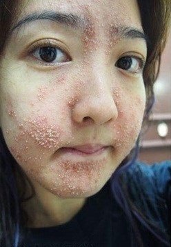 Rùng mình màn hướng dẫn tắm trắng MA CÀ RỒNG tại nhà với nguyên liệu dung dịch vệ sinh phụ nữ-6