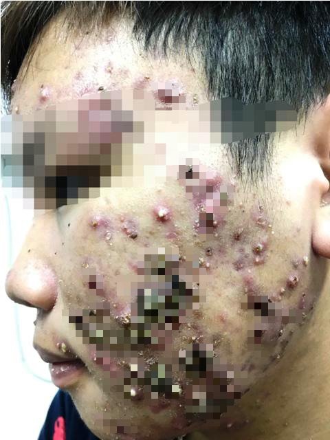 Rùng mình màn hướng dẫn tắm trắng MA CÀ RỒNG tại nhà với nguyên liệu dung dịch vệ sinh phụ nữ-7