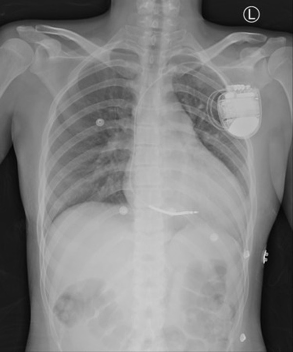 Cô gái trẻ ngất xỉu trong lúc trò chuyện với người thân, nguyên nhân phía sau khiến người trẻ tuổi cũng phải dè chừng-1