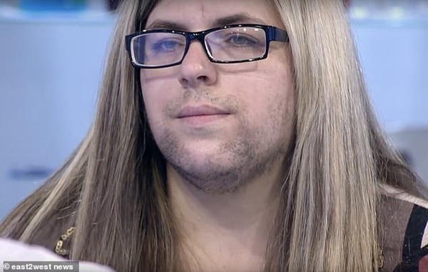 Sau khi sinh, người phụ nữ đột nhiên biến thành đàn ông khiến chồng không dám hôn-1