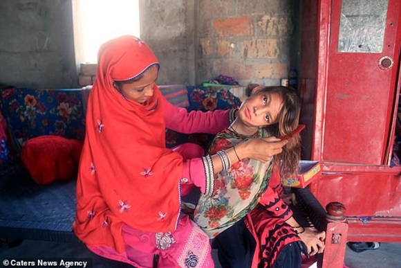 Mắc bệnh lạ gây trẹo cổ 90 độ, bé gái phải chịu đựng nỗi đau hàng ngày vì gia đình không đủ tiền chữa trị-1