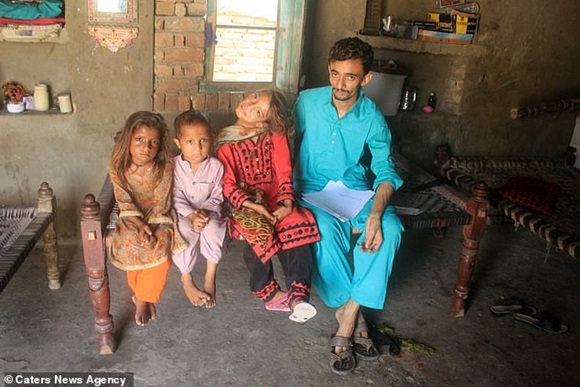 Mắc bệnh lạ gây trẹo cổ 90 độ, bé gái phải chịu đựng nỗi đau hàng ngày vì gia đình không đủ tiền chữa trị-2