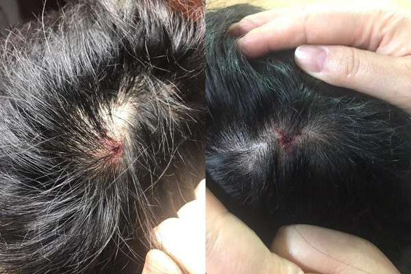 Xuất thân của Tân Hoa hậu Hàn Quốc có bố tù tội đang bị đào bới-5