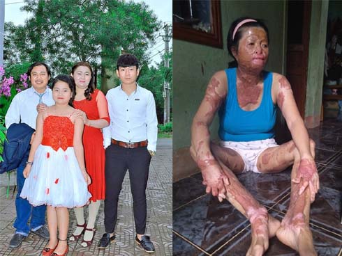 Đang chơi ở sân chung cư, cậu bé 8 tuổi bất ngờ bị một đám trẻ tưới xăng lên người và thiêu sống-4
