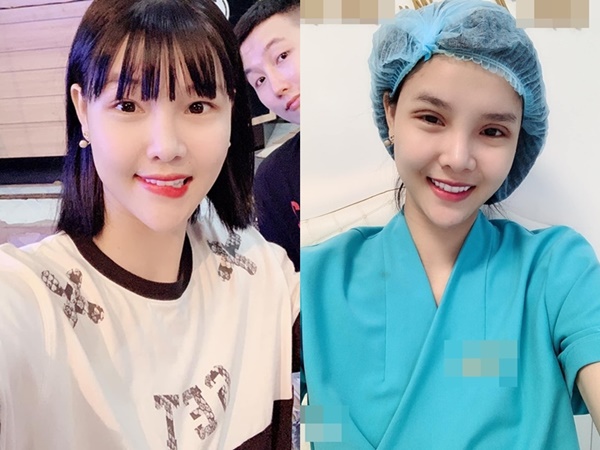 Bất chấp sự phản đối của Mạc Hồng Quân, Kỳ Hân công khai phẫu thuật thẩm mỹ lần thứ n với gương mặt sưng phù khó nhận diện-5