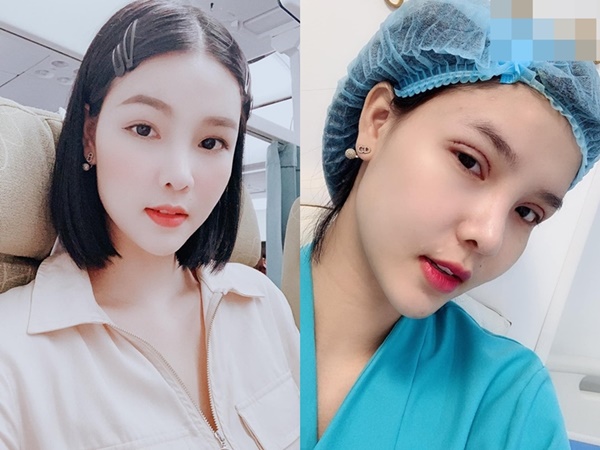 Bất chấp sự phản đối của Mạc Hồng Quân, Kỳ Hân công khai phẫu thuật thẩm mỹ lần thứ n với gương mặt sưng phù khó nhận diện-7