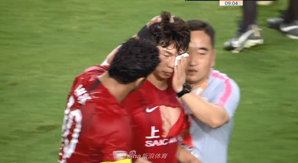 Cầu thủ Trung Quốc gây phẫn nộ sau tình huống vung chân đạp thẳng vào mắt của đối thủ-1