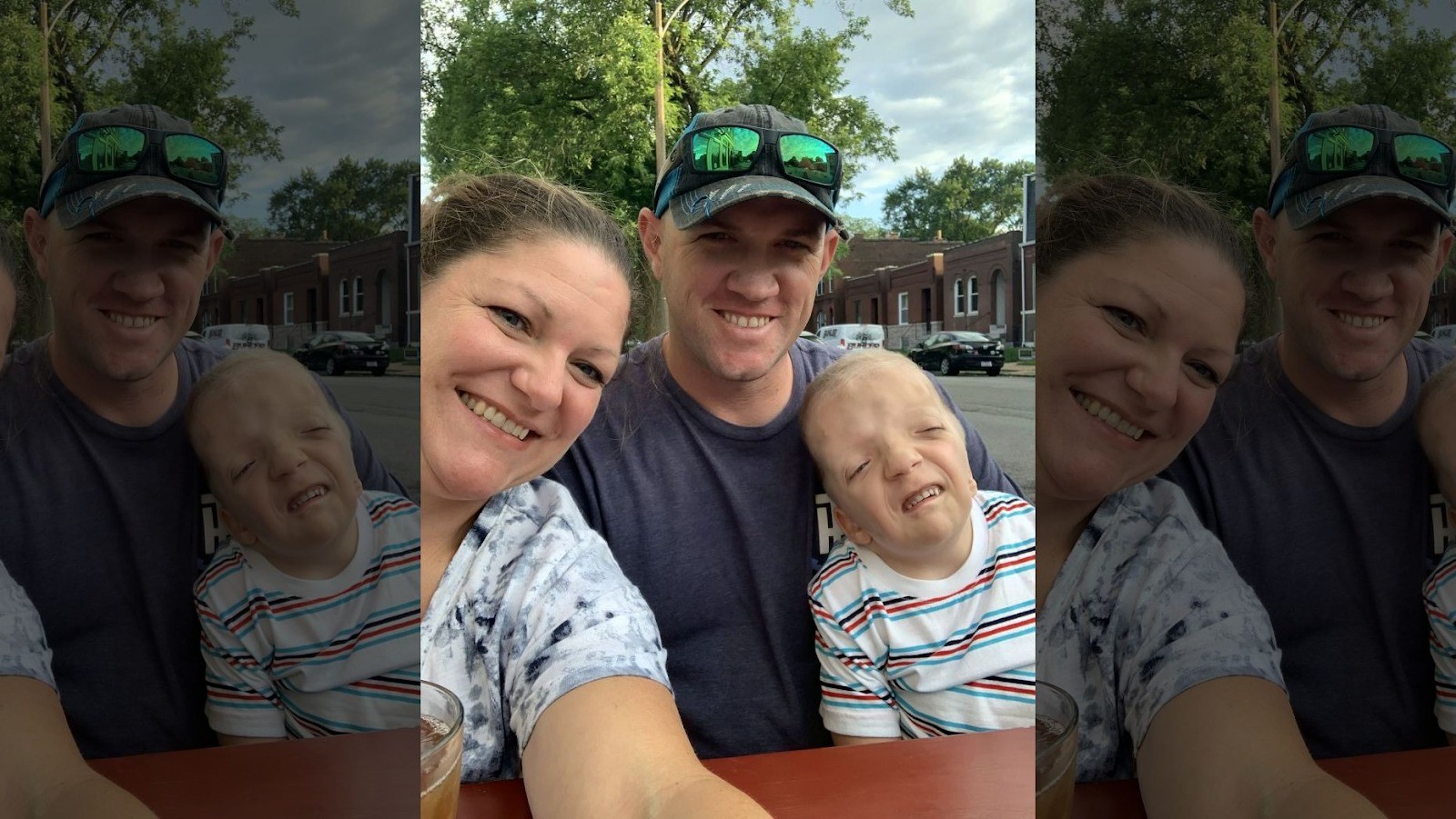 Nằm trong bụng mẹ khỏe mạnh, bé trai chào đời với hình hài kỳ lạ khiến gia đình sợ hãi và hội chứng duy nhất chỉ có mình em mắc phải-1