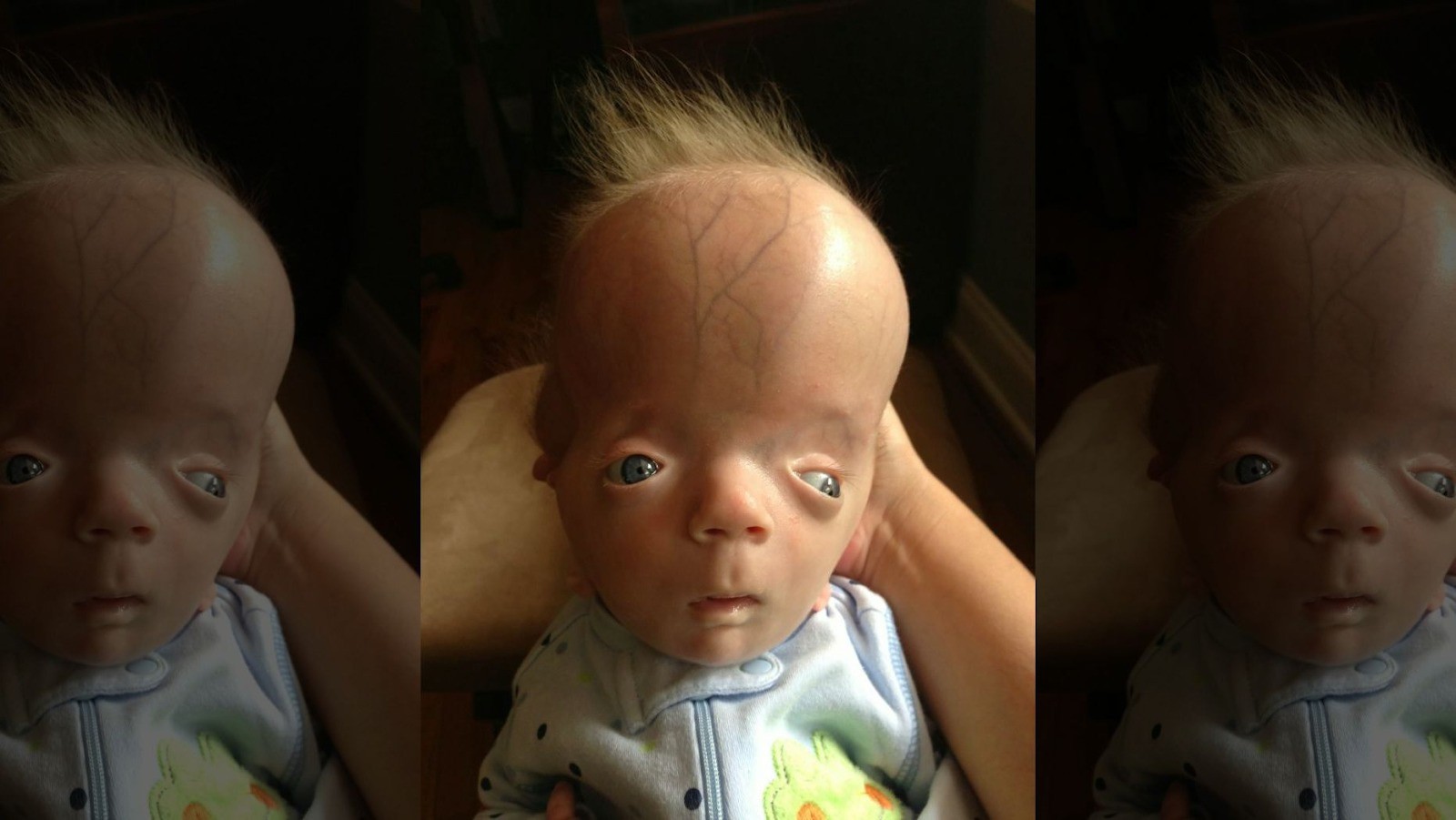 Nằm trong bụng mẹ khỏe mạnh, bé trai chào đời với hình hài kỳ lạ khiến gia đình sợ hãi và hội chứng duy nhất chỉ có mình em mắc phải-2