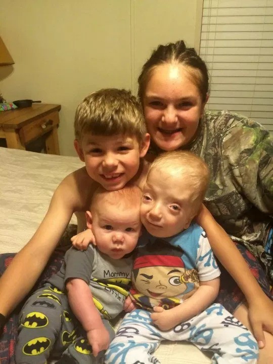 Nằm trong bụng mẹ khỏe mạnh, bé trai chào đời với hình hài kỳ lạ khiến gia đình sợ hãi và hội chứng duy nhất chỉ có mình em mắc phải-3