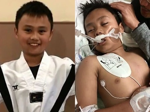 Người phụ nữ bị phát ban đáng sợ bởi chứng bệnh lạ dễ bị bùng phát khi gặp cảm lạnh-4