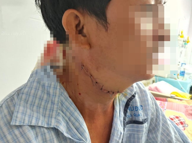 Nóng: Bắt giữ nghi phạm cứa cổ tài xế xe ôm công nghệ ở TP.HCM-2