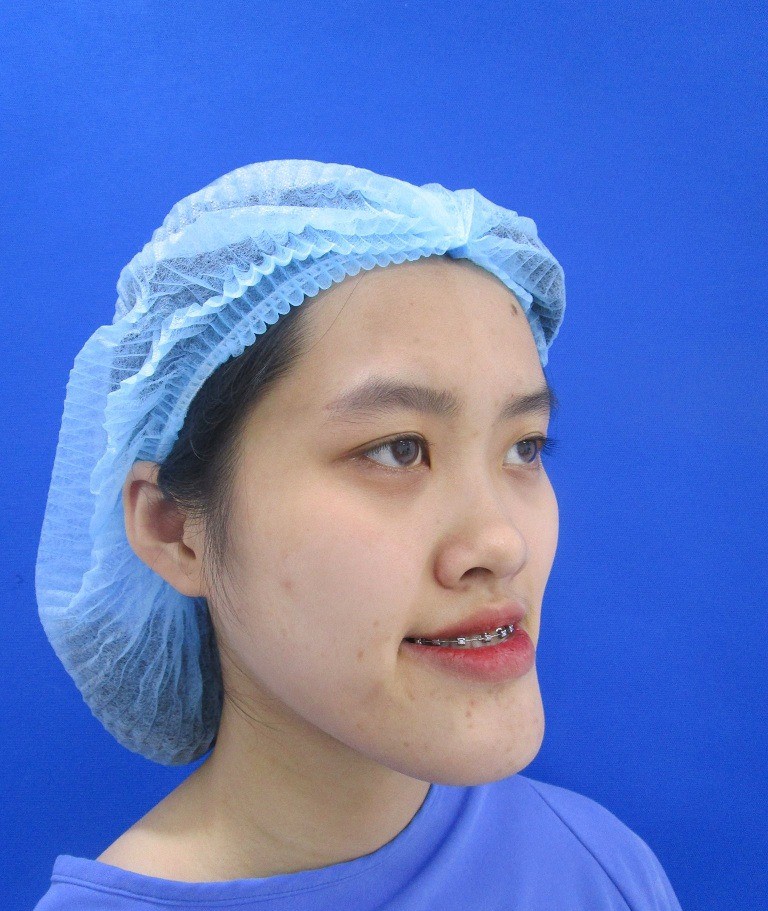 Chi gần 300 triệu, cô nàng từng bị gọi đồ mặt rắn thay đổi ngoạn mục khiến chị em khen ngợi không ngớt-1