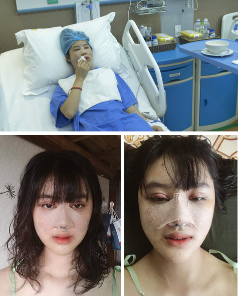 Chi gần 300 triệu, cô nàng từng bị gọi đồ mặt rắn thay đổi ngoạn mục khiến chị em khen ngợi không ngớt-2