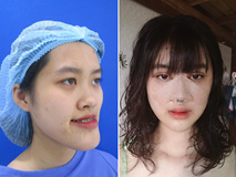 Chi gần 300 triệu, cô nàng từng bị gọi "đồ mặt rắn" thay đổi ngoạn mục khiến chị em khen ngợi không ngớt Chi gần 300 triệu, cô nàng từng bị gọi "đồ mặt rắn" thay đổi ngoạn mục khiến chị em khen ngợi không ngớt