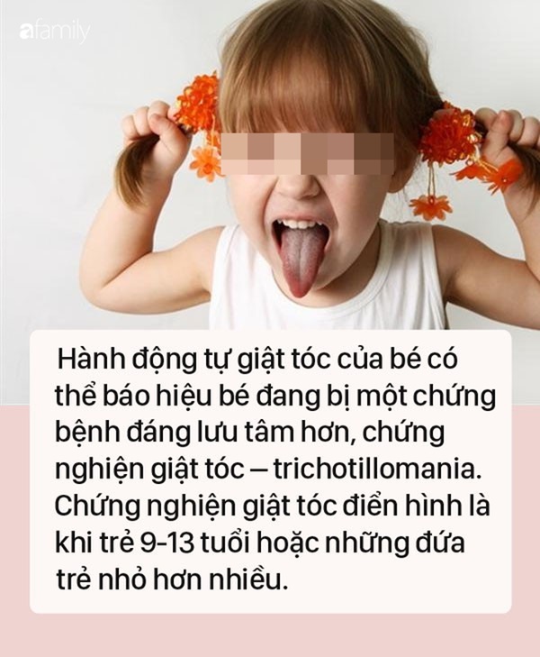 Thấy con hay tự giật tóc của mình, mẹ cần xử lý ngay vì rất có thể đó là dấu hiệu của một bệnh nghiêm trọng-1