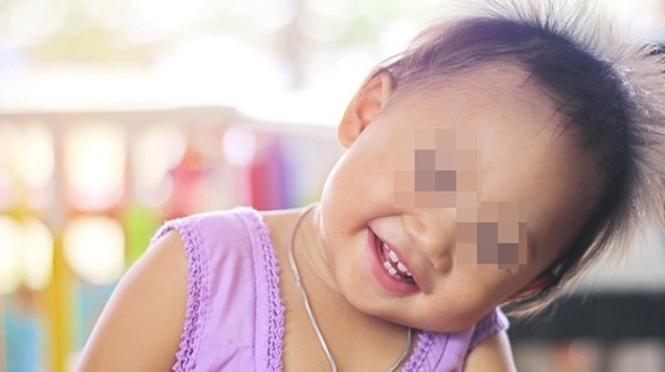 Thấy con hay tự giật tóc của mình, mẹ cần xử lý ngay vì rất có thể đó là dấu hiệu của một bệnh nghiêm trọng-2