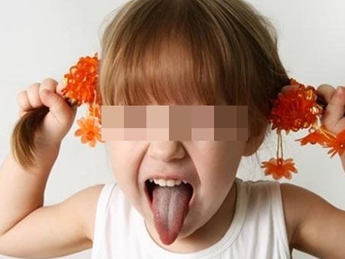 Thấy con hay tự giật tóc của mình, mẹ cần xử lý ngay vì rất có thể đó là dấu hiệu của một bệnh nghiêm trọng