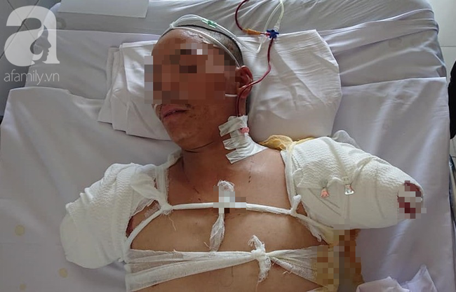 Vợ nghẹn ngào ký giấy đồng ý đoạn chi 2 tay chồng vì điện giật: Không biết khi nào anh ấy mới về với mẹ con em-1