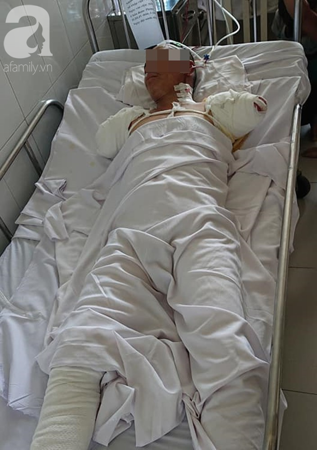 Vợ nghẹn ngào ký giấy đồng ý đoạn chi 2 tay chồng vì điện giật: Không biết khi nào anh ấy mới về với mẹ con em-2