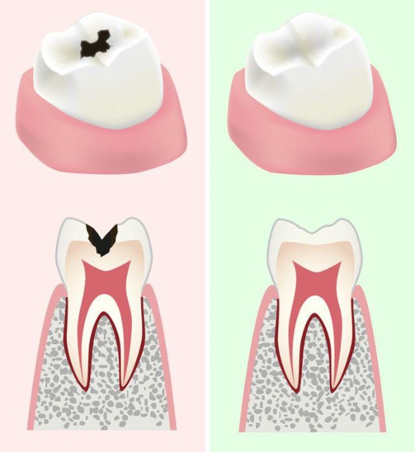 13 lợi ích bất ngờ nếu ăn dưa chuột mỗi ngày, có tới 3 điều chị em sẽ rất thích-12