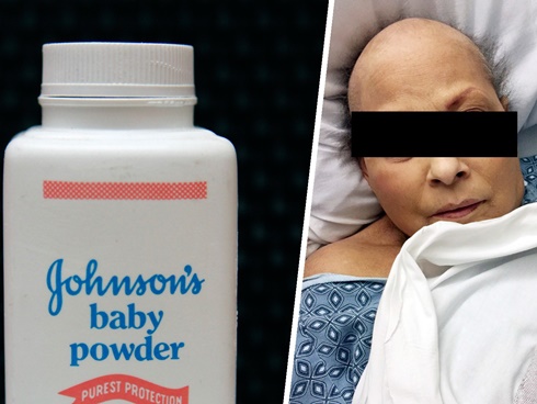 Ngoài việc phấn rôm Johnson & Johnson chứa chất gây ung thư, đây là những lý do bác sĩ khuyên không nên dùng phấn rôm cho trẻ, nhất là bé gái-4